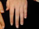 Nagelbitare