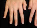 Nagelbitare