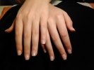 Nagelbitare