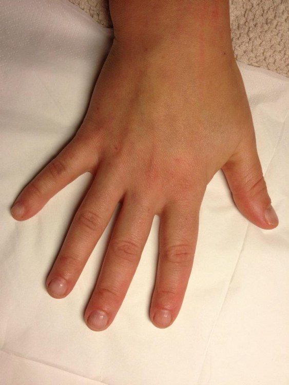 My nails before