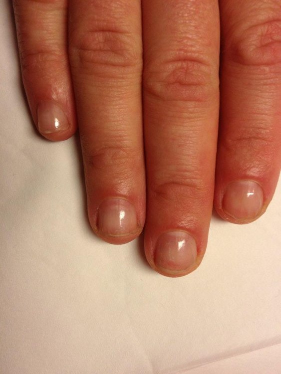 My nails before