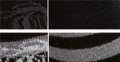BOA203202-platta