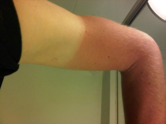This might hurt in the morning...
